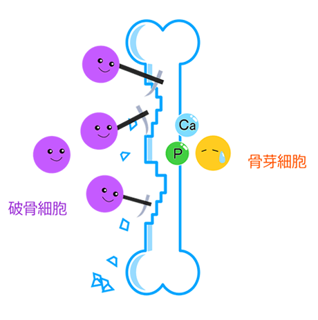 生活習慣病とも関連 骨粗鬆症 草花クリニック あきる野市 内科 訪問診療 リハビリ